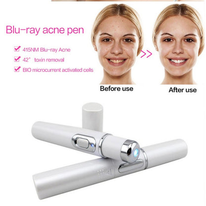 Kingdom, Blue Light Therapy Acne Laser Pen, Soft Scar Wrinkle Removal Treatment, Skin Care Beauty Technology