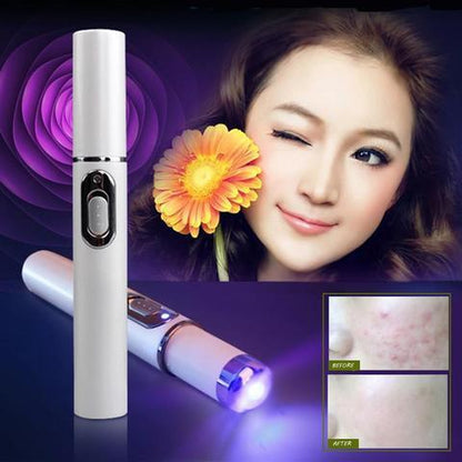 Kingdom, Blue Light Therapy Acne Laser Pen, Soft Scar Wrinkle Removal Treatment, Skin Care Beauty Technology