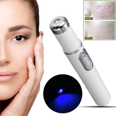 Kingdom, Blue Light Therapy Acne Laser Pen, Soft Scar Wrinkle Removal Treatment, Skin Care Beauty Technology